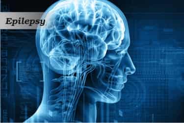 Epilepsy-treatment-gurgaon